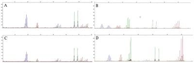 Concordance between microsatellite instability and mismatch repair protein expression in colorectal cancer and their clinicopathological characteristics: a retrospective analysis of 502 cases